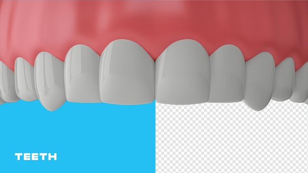 PSD dents supérieures