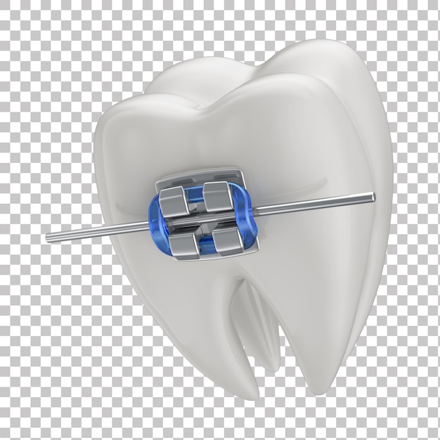 Diente con aparatos ortopédicos en fondo transparente aislado en 3D Icono de diente en 3D Clínica dental de salud