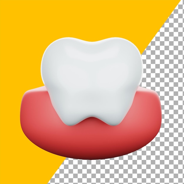 PSD diente molar 3d