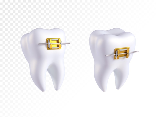 Dientes con o sin brackets de oro. Arco ortodoncia sin dientes. Odontología de ortodoncia.