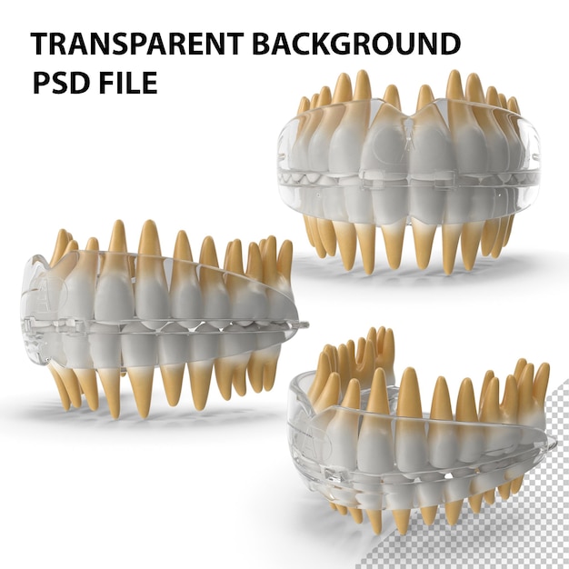 Dispositif de retenue de dent orthodontique dentaire PNG