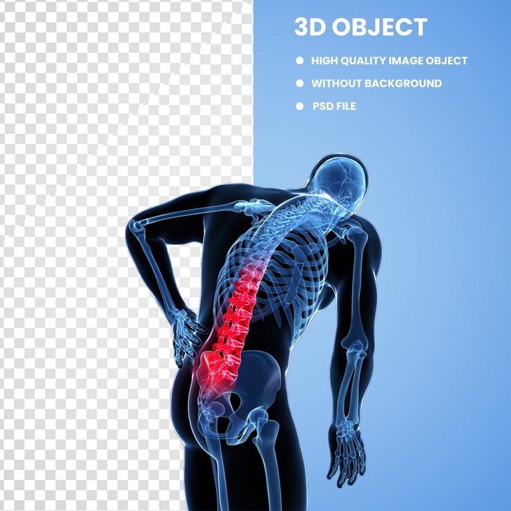 PSD dolor lumbar en el cuello