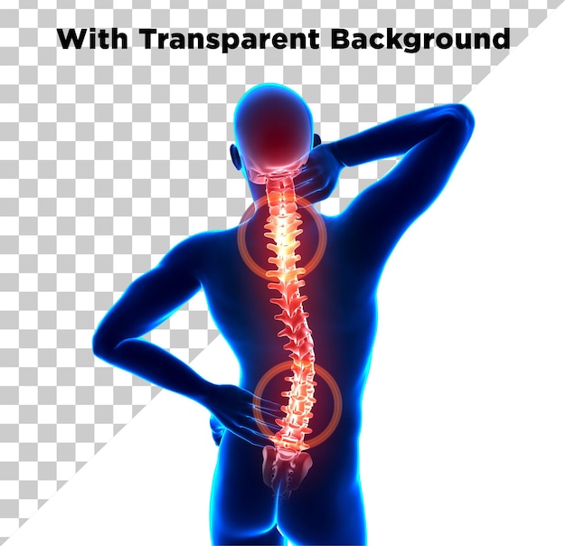 Dor nas costas ou dor na coluna PNG PSD isolado em fundo transparente