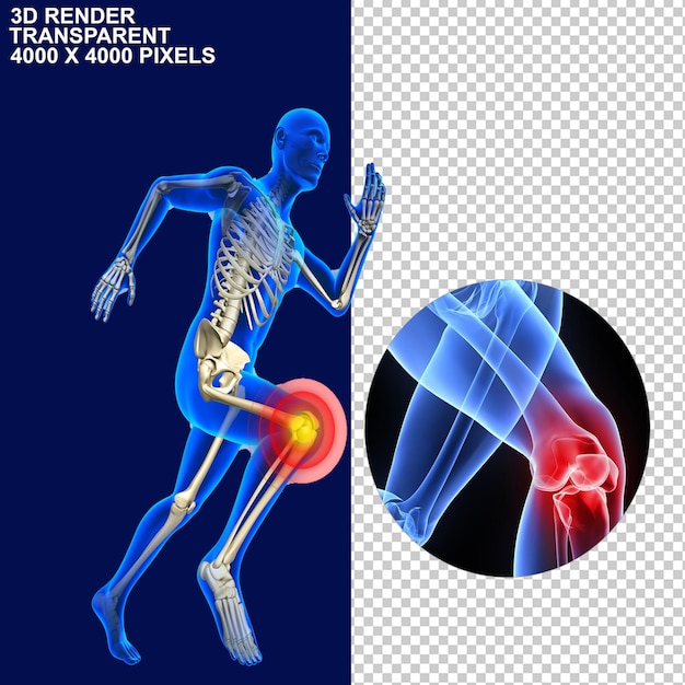 Douleurs articulaires Douleurs au dos Douleurs aux articulations Douleurs au cou Douleurs au genou Douleurs au haut du dos Au bas du dos Squelette cérébral