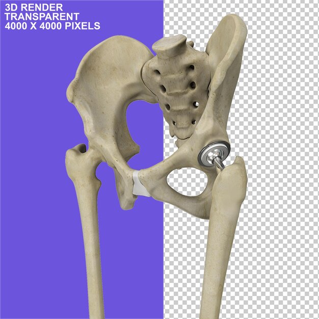 PSD esqueleto músculos huesos dolores de espalda dolor en las articulaciones terapia de rodilla ejercicio de reemplazo óseo.