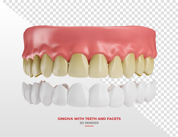 Goma com dentes amarelos e folheado em renderização 3D com fundo transparente