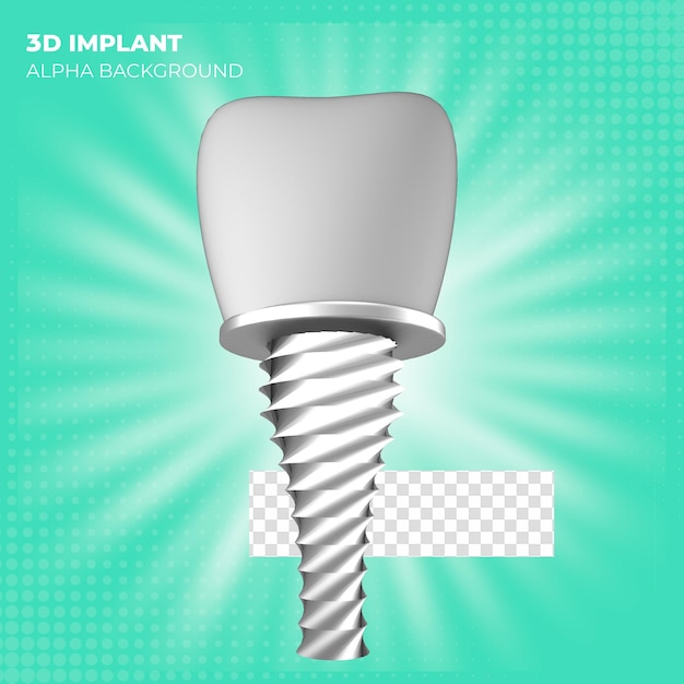 PSD icône d'implant dentaire blanc de rendu 3d