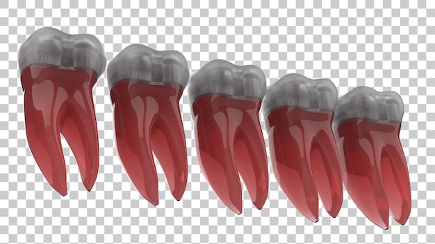 PSD illustration d'implant de dent isolée sur un fond transparent en 3d