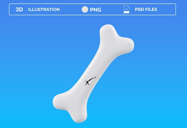 Ilustração 3D do osso PSD