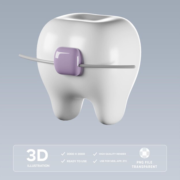 Ilustración 3D de los aparatos ortopédicos PSD