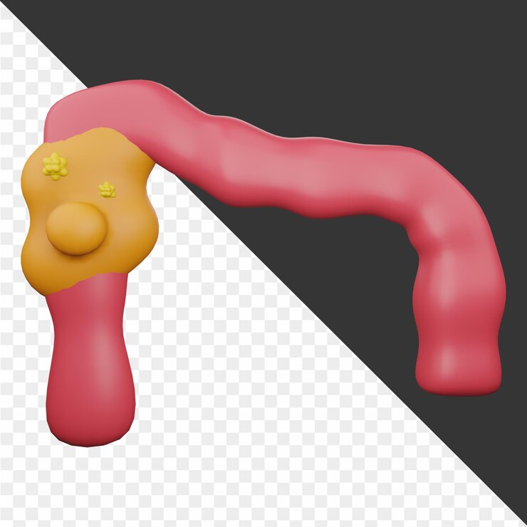 PSD ilustración 3d del cáncer