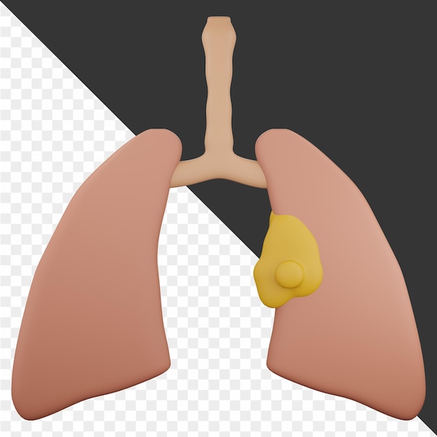 PSD ilustración 3d del cáncer