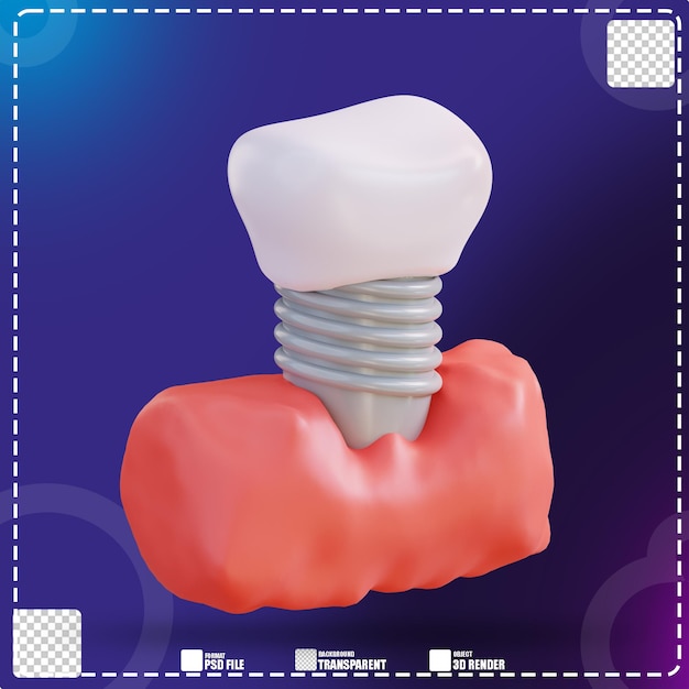 PSD ilustración 3d de dentaduras postizas 3