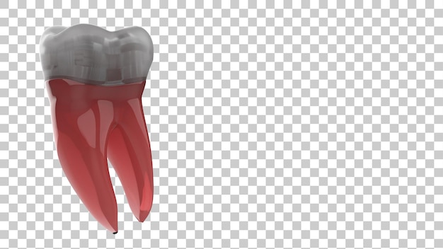 PSD ilustración 3d del diente del implante aislado sobre un fondo transparente