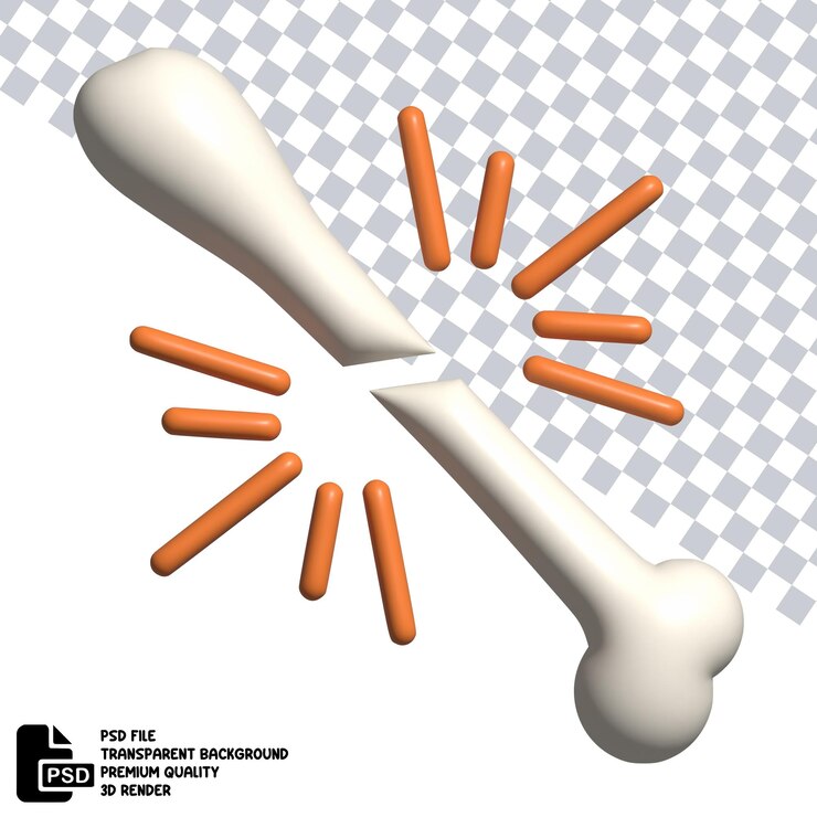 PSD ilustración 3d de hueso roto