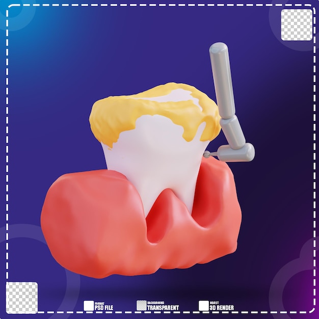 PSD ilustración 3d de limpieza de sarro con un taladro dental 2