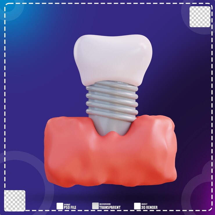PSD ilustración 3d de montaje de prótesis dentales 2
