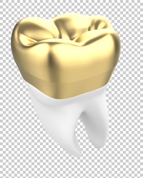 Implant Dentaire Sur Fond Transparent Illustration De Rendu 3d