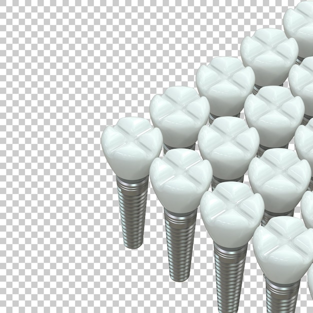 Implante de dente na ilustração de renderização 3d de fundo transparente