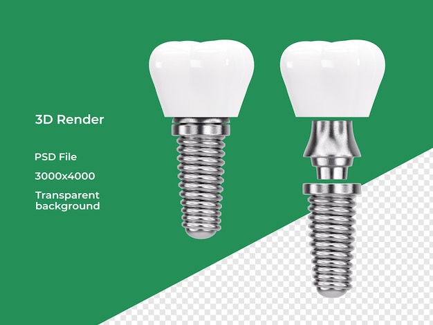 Implante dental desmontado y montado aislado en representación 3d de fondo transparente