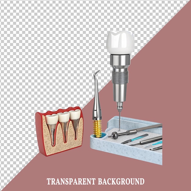 Implants dentaires et outils à fond transparent
