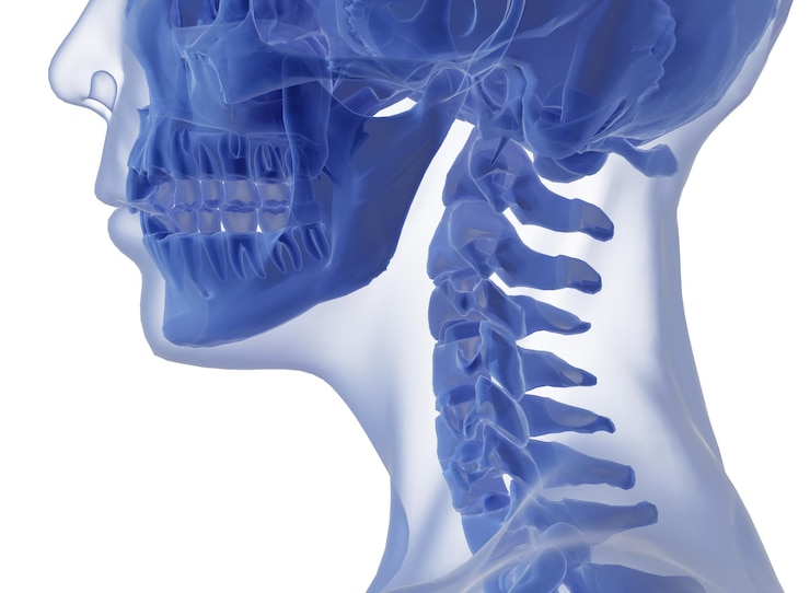 PSD lado de la columna cervical