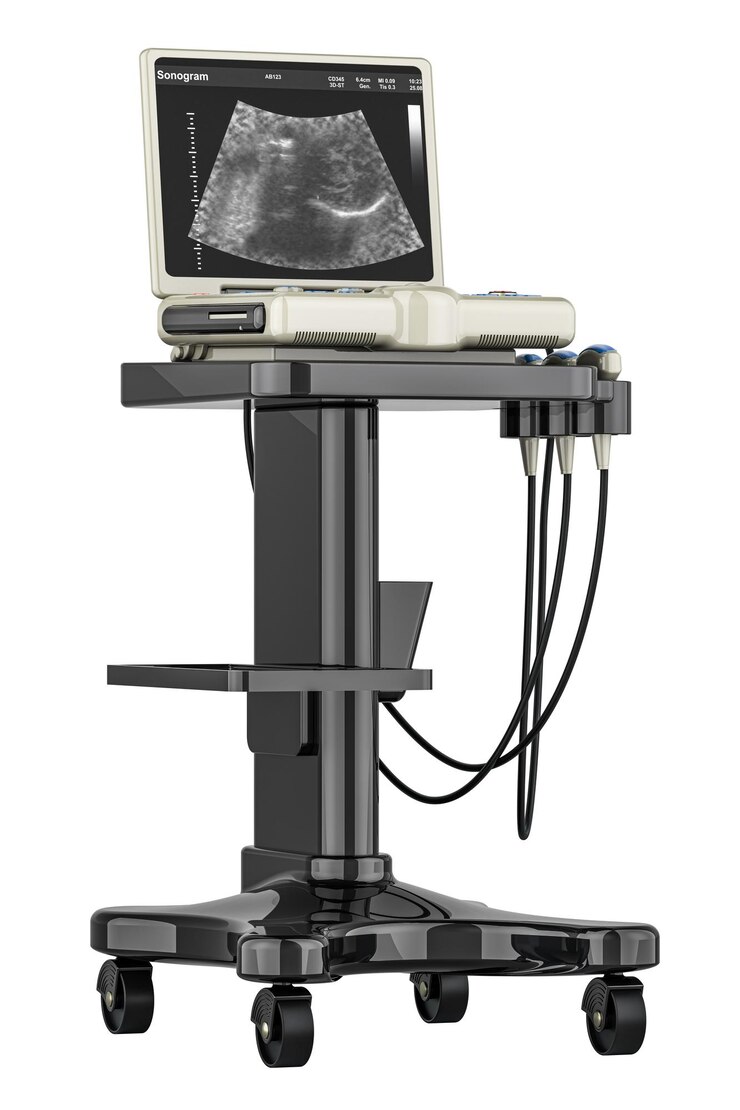 PSD máquina de diagnóstico por ultrassom médico sistema de diagnóstico por ultra-som 3d isolado em fundo transparente
