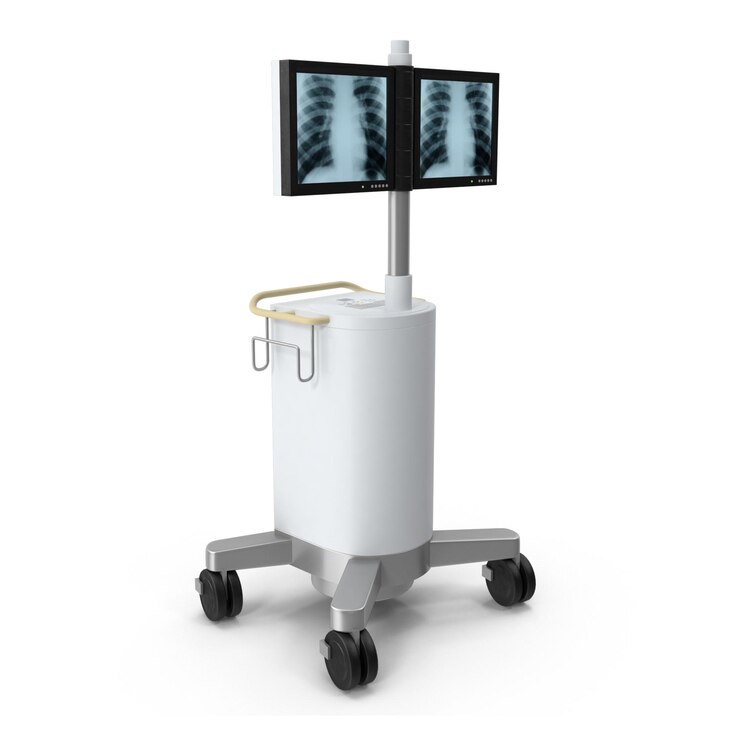 PSD medical x-ray imaging system with chest radiographs on display