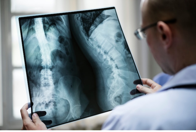 Médico con una película de rayos X del paciente.
