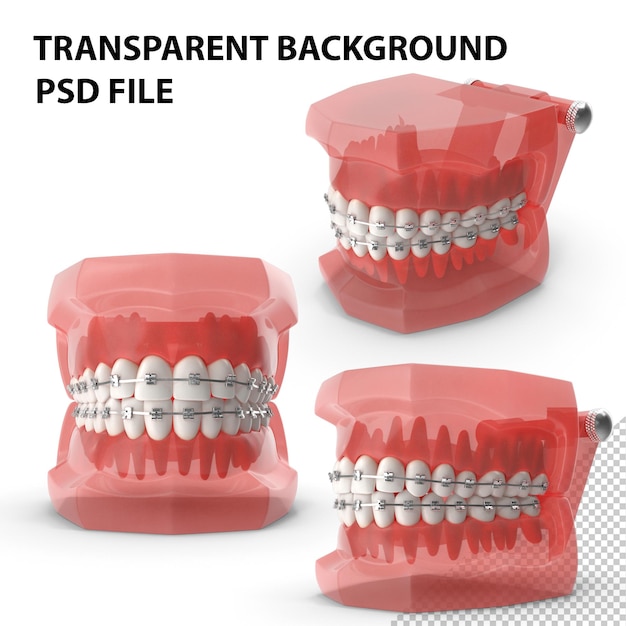 PSD modèle de dents typodont avec supports png