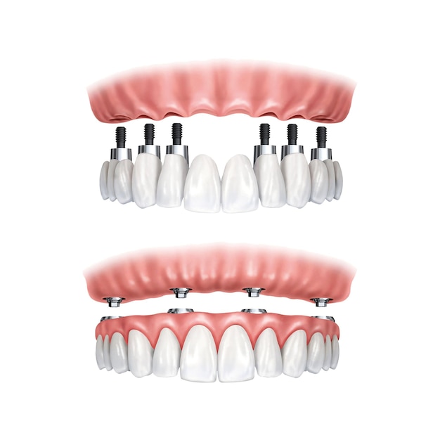 PSD modèle de présentation médicale dentaire