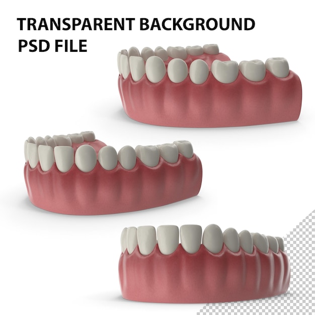 Modello medico dei denti inferiori con impianto dentale PNG