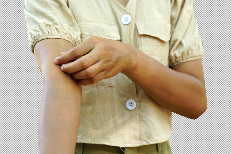 PSD mujer asiática, tener, un, picazón, brazo