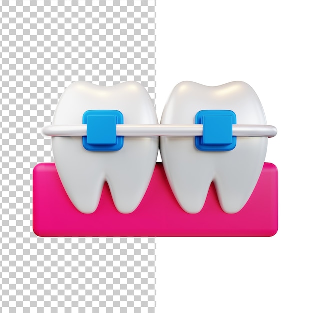 El paquete de ilustraciones 3D de los aparatos dentales