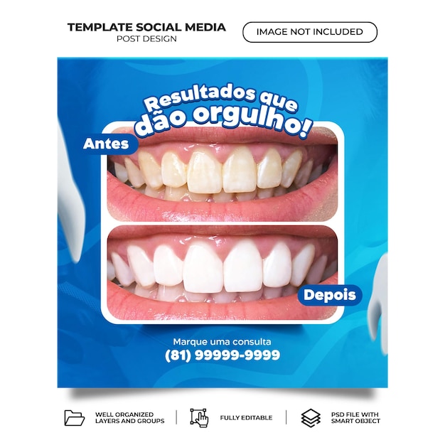 PSD plantilla de banner de redes sociales de moda de dentista y cuidado dental psd portugués brasileño