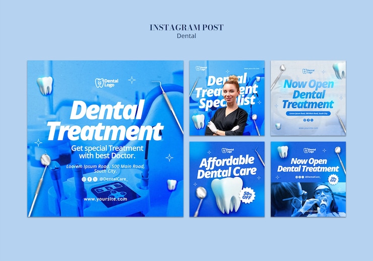 PSD progettazione del modello dentale