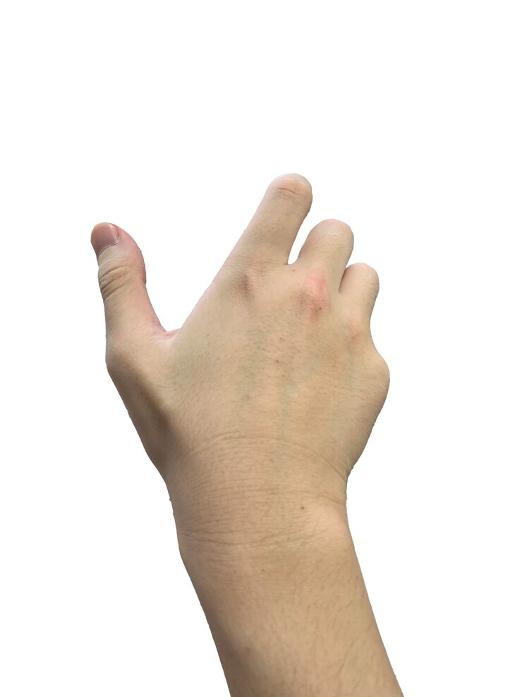 propia mano