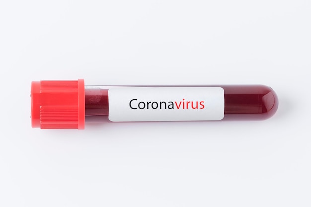 Provetta per l'analisi del sangue del coronavirus