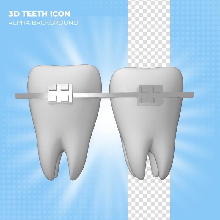 PSD renderizado de ortodoncia 3d con dos dientes blancos