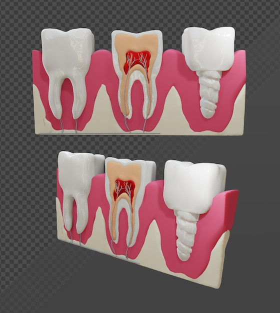 Representación 3d de la vista en perspectiva de la estructura dental