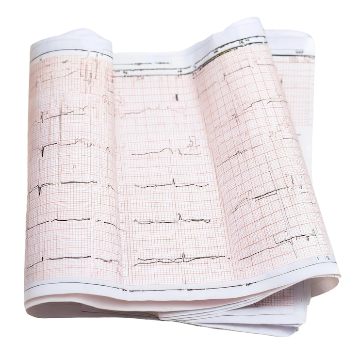 PSD resultados del ecg en conjunto