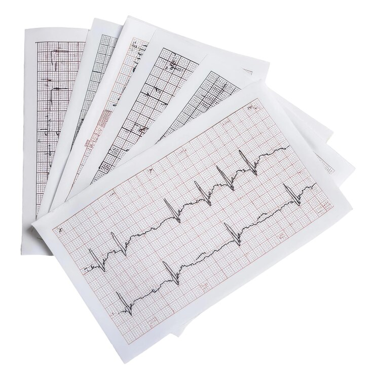 PSD resultados del ecg en papel