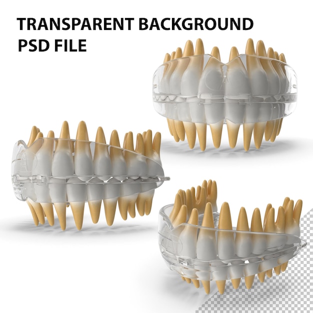 PSD retentor de dente ortodôntico dental png