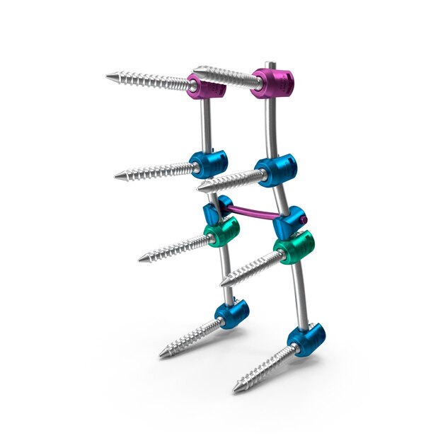 Spinal Fusion Implant System