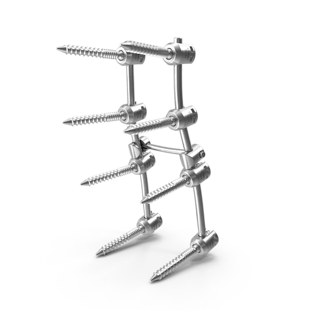 Spinal Implant Orthopedic Hardware for Spinal Stabilization