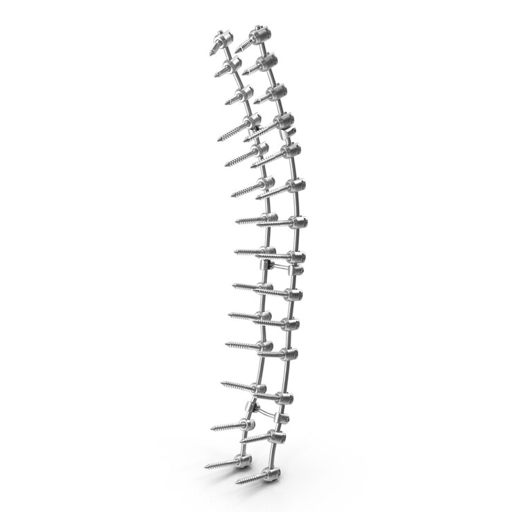 PSD spinal implant surgical hardware for spinal fusion and orthopedic procedures