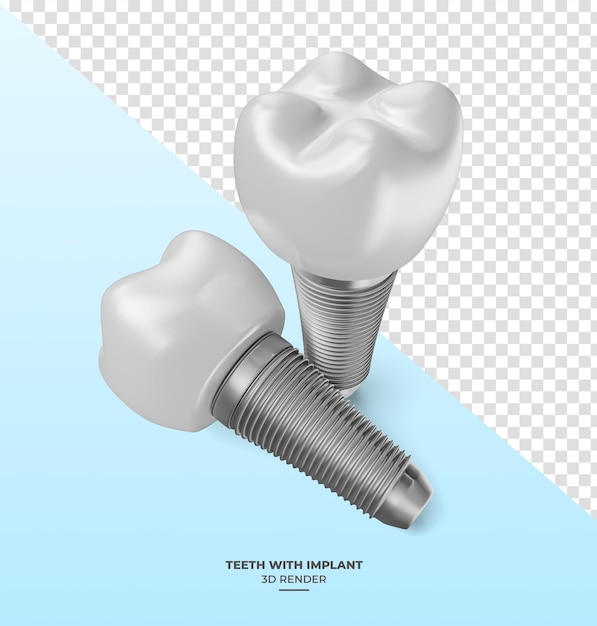 teeth with implants in 3d render with transparent background