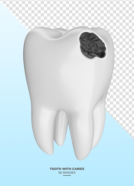 Tooth with caries in 3d render with transparent background