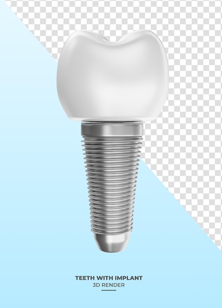 tooth with implants in 3d render with transparent background