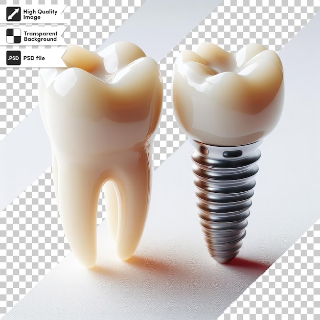 Le Traitement De Blanchiment Des Dents Psd Est Un Remplissage Sur Fond Transparent Avec Une Couche De Masque Modifiable.